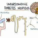 Kenali Gejala dan Jenis Diabetes Insipidus